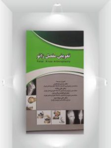 تعویض زانو