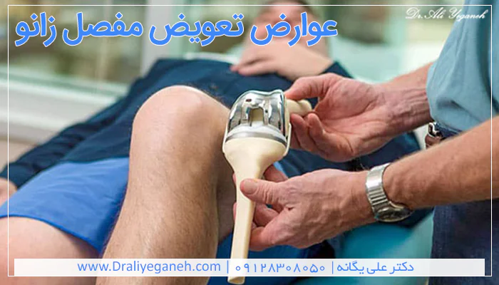 عوارض تعویض مفصل زانو