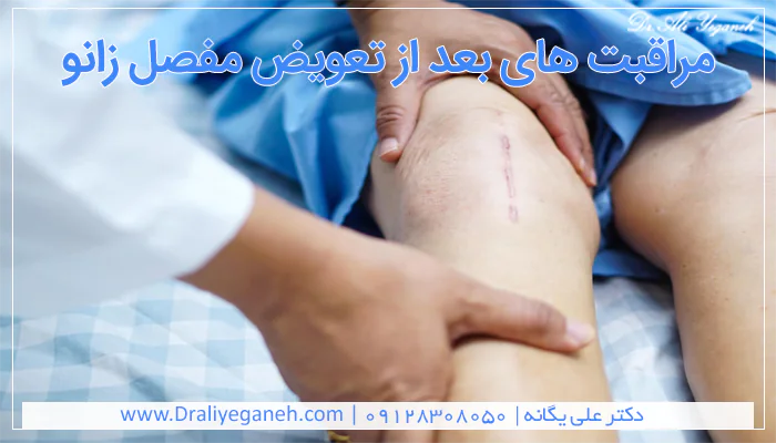 مراقبت های بعد از تعویض مفصل زانو