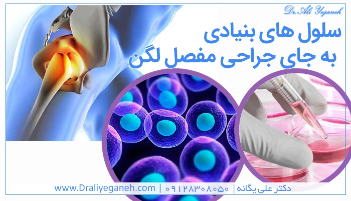 درمان‌ های جایگزین جراحی مفصل لگن